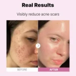 سرم نیاسینامید15% کوزارکس - تصویر 3