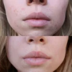 کرم ترمیم کننده سیکاپلاست لاروش پوزای - تصویر 2